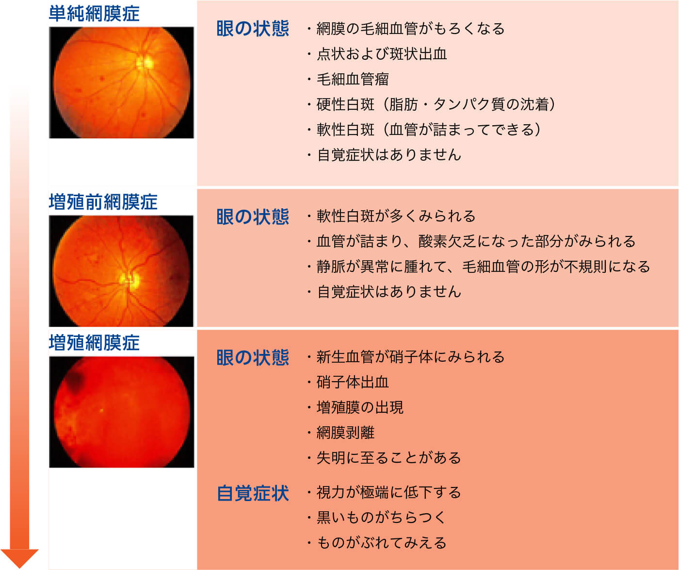 図「糖尿病網膜症の進行の経過と症状」